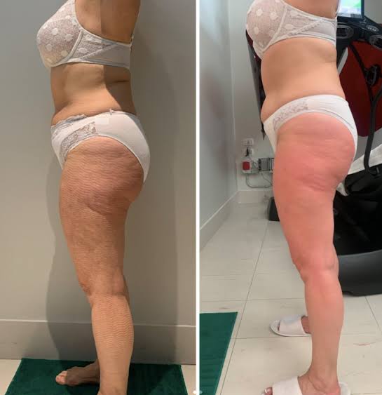 T-Shape 2 result — 0a74f458 8f27 49bd 8717 af08c3faf438