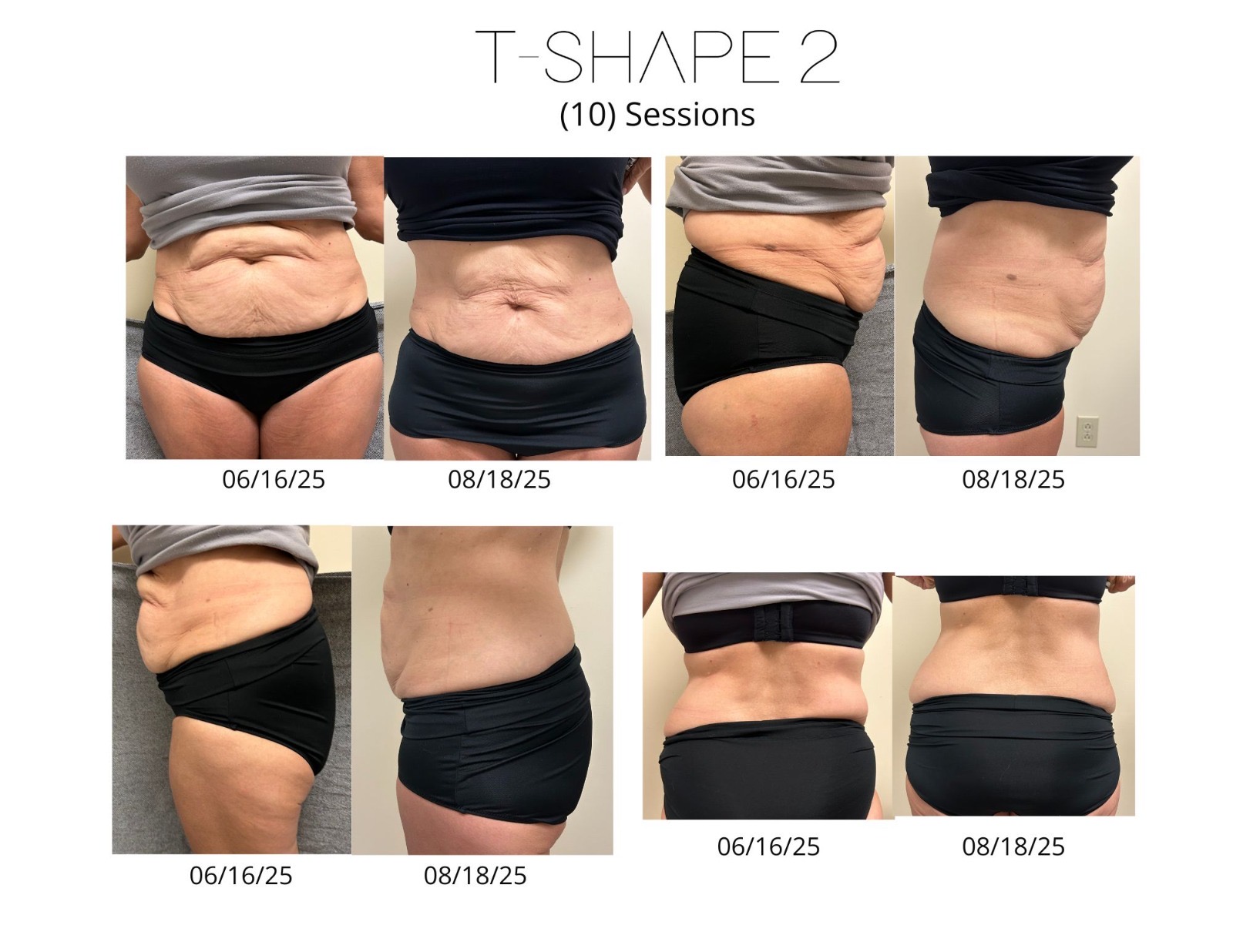 T-Shape 2 result — 10 sessions Corning Wellness
