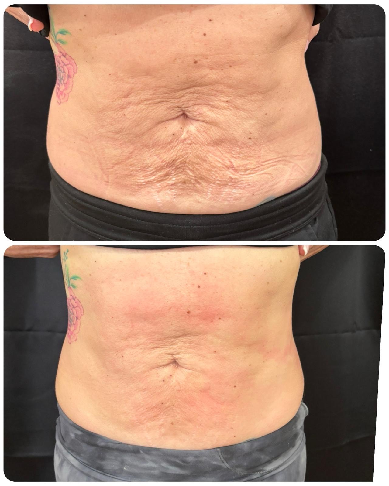 T-Shape 2 result — 3 sessions