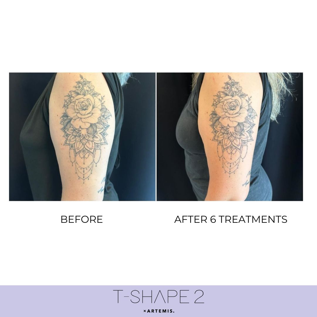 T-Shape 2 result — 3