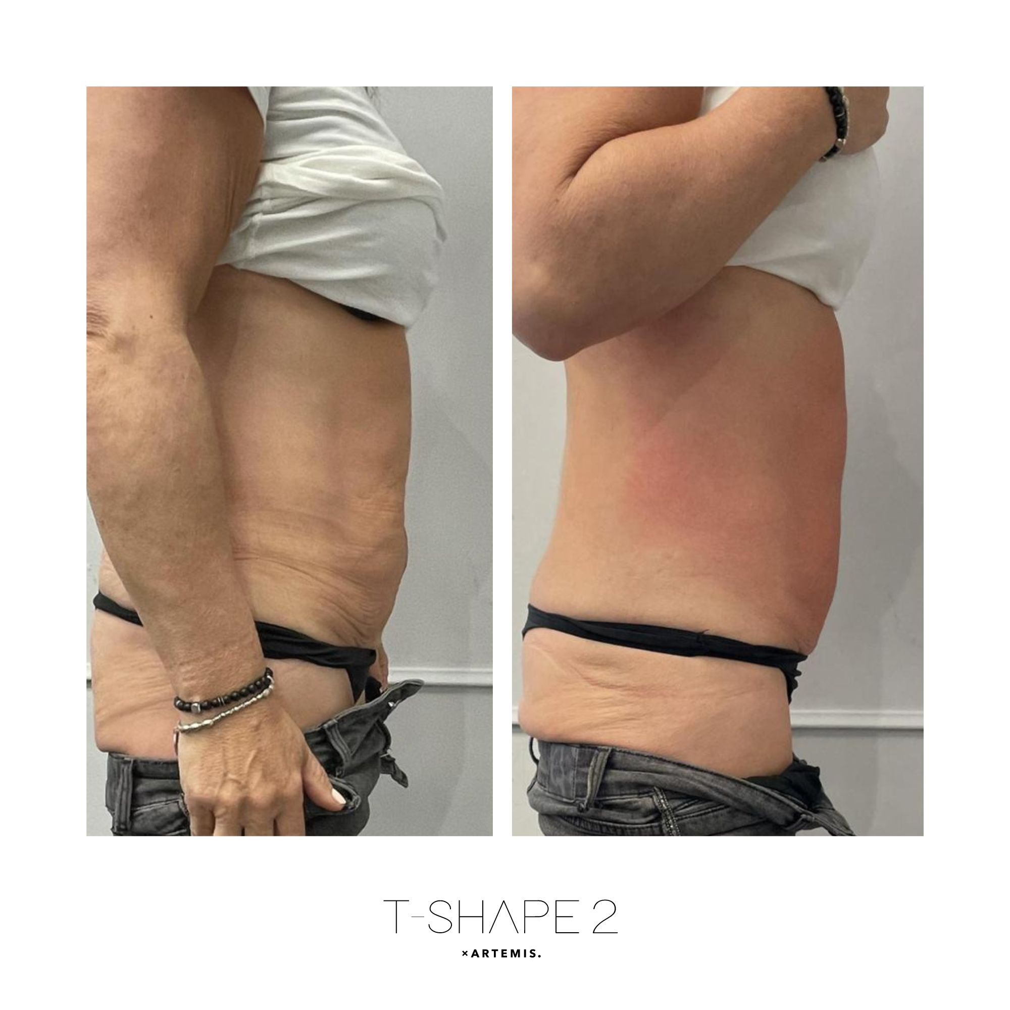 T-Shape 2 result — Abs 1