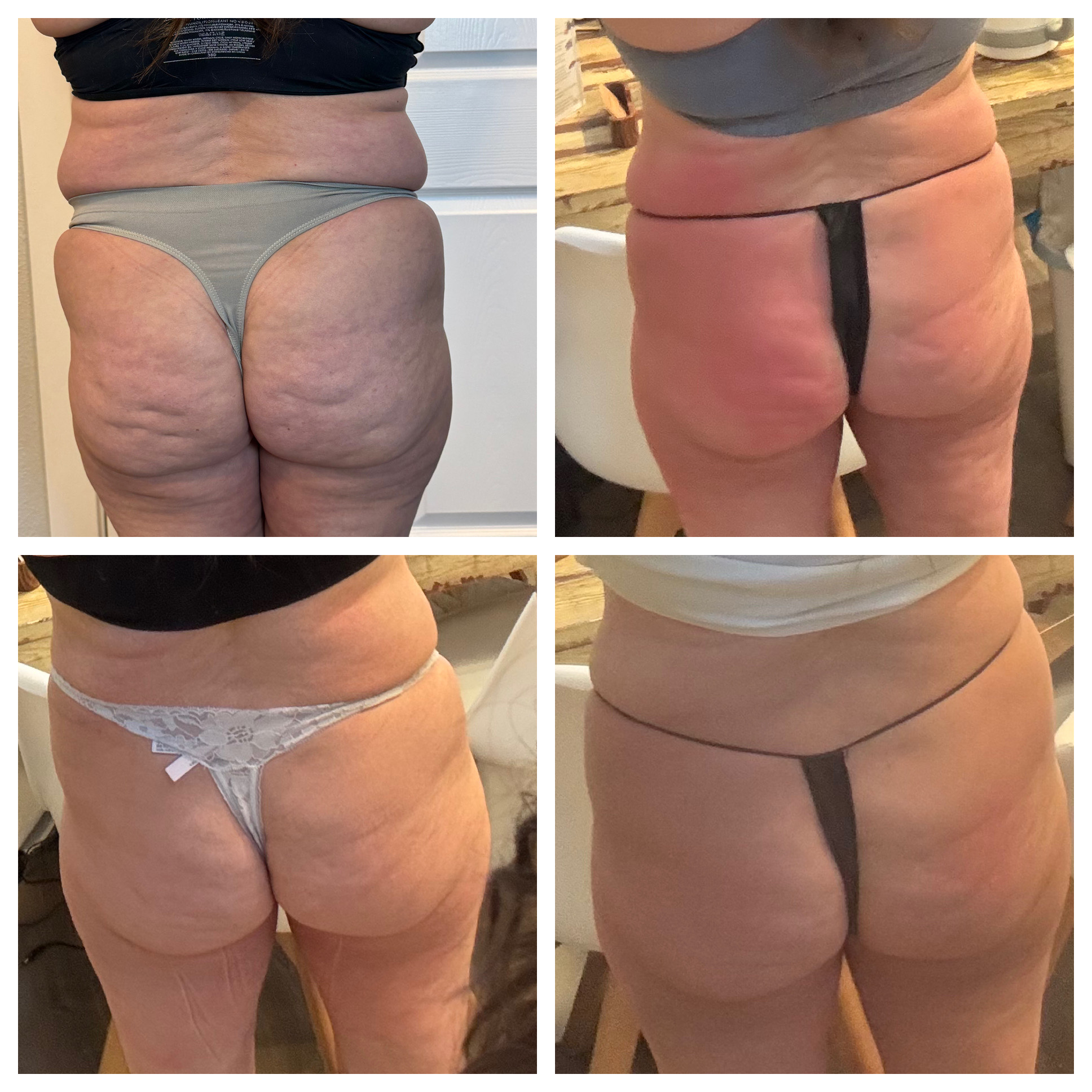 T-Shape 2 result — After 8 sessions (2)