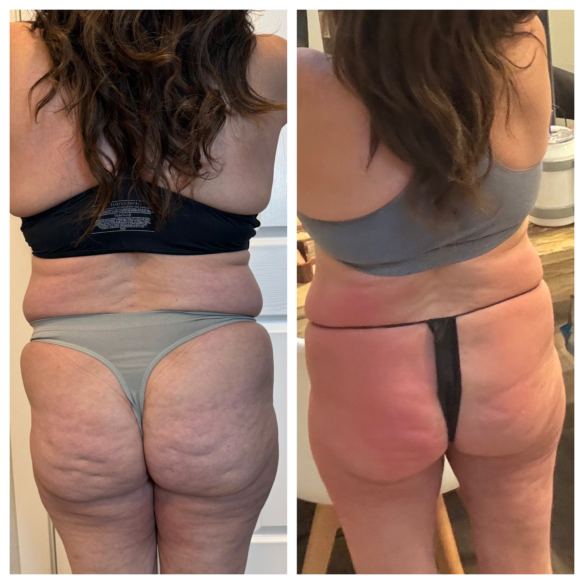 T-Shape 2 result — After 8 sessions