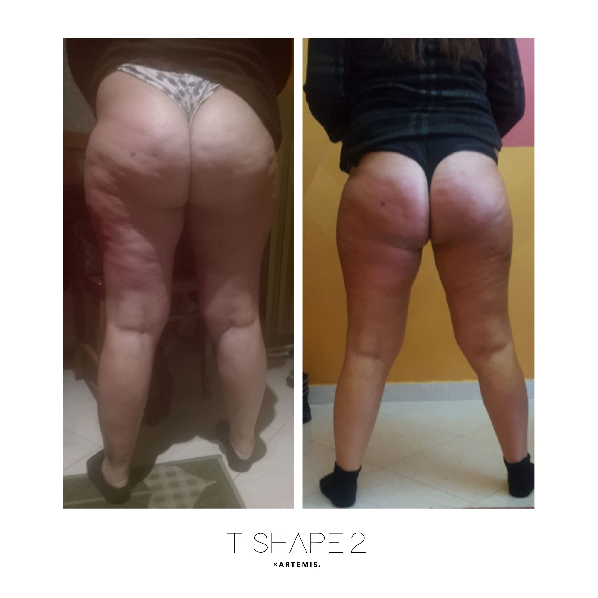 T-Shape 2 result — Legs 3