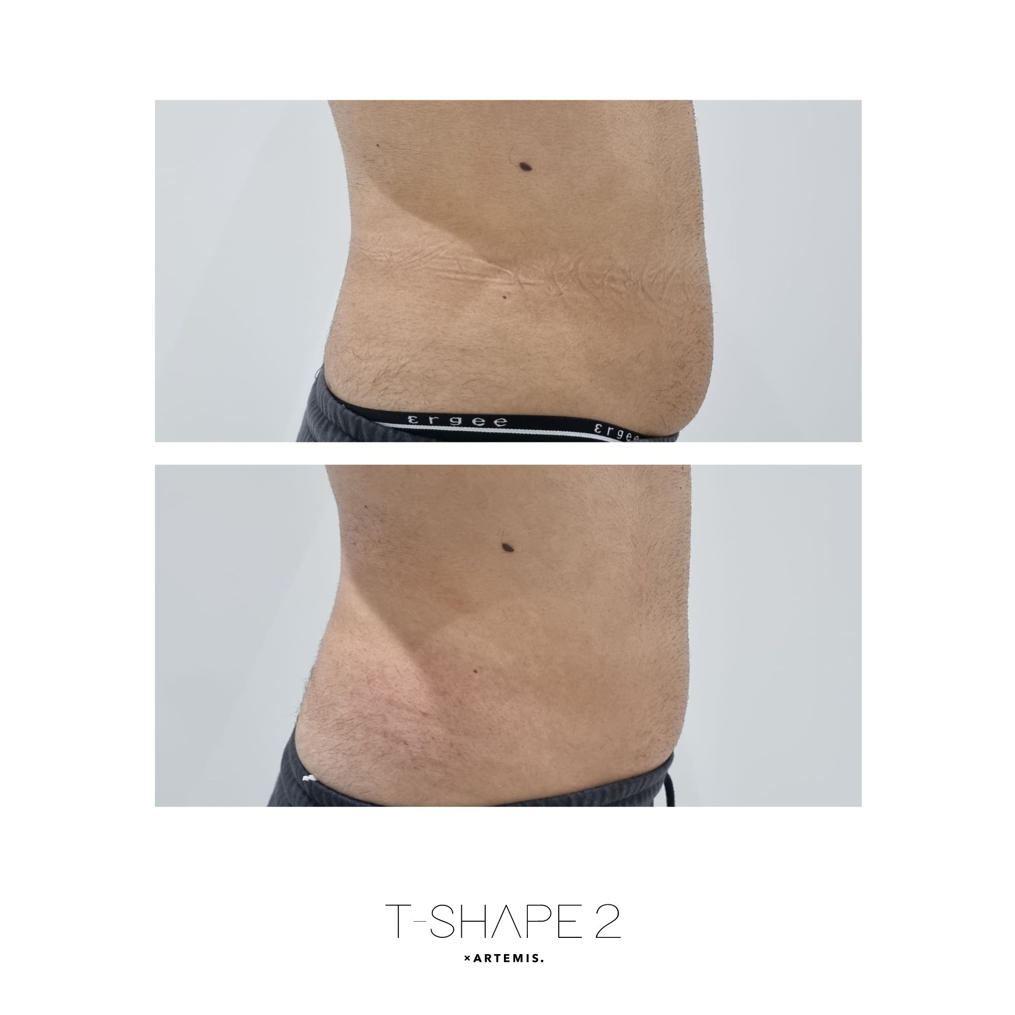 T-Shape 2 result — Side 1