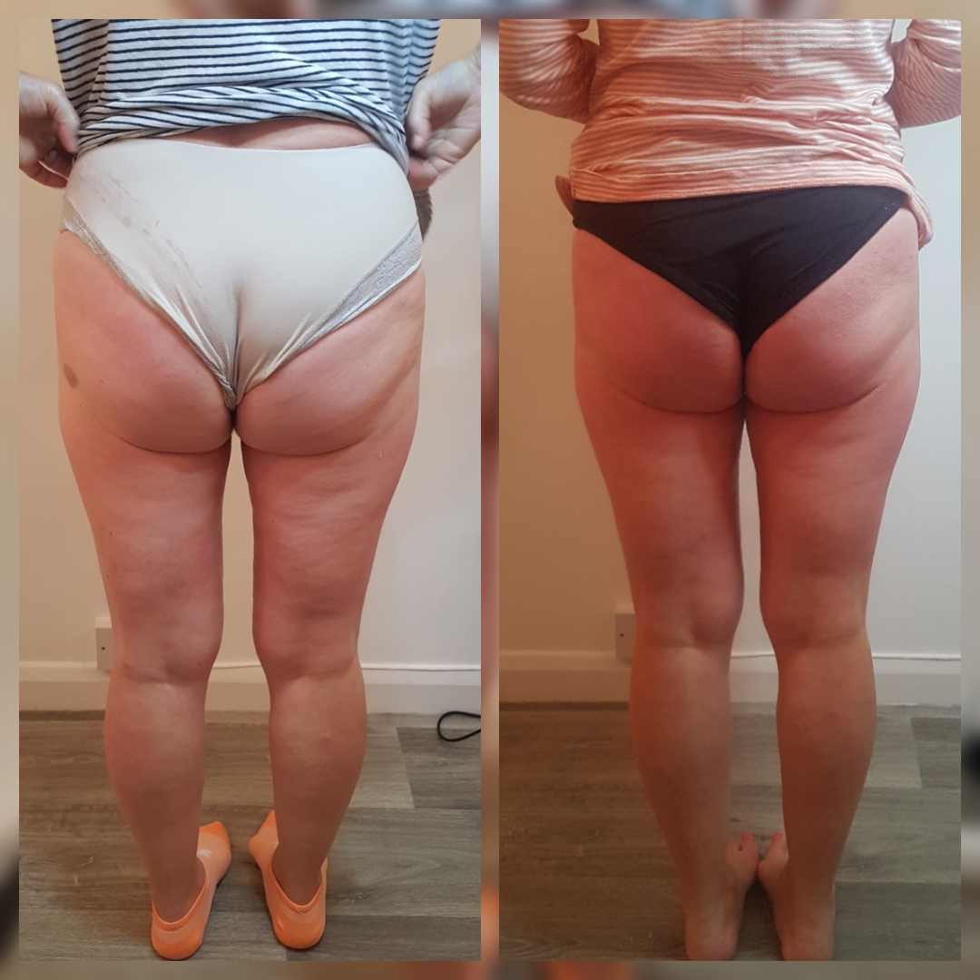T-Shape 2 result — T shape after 2